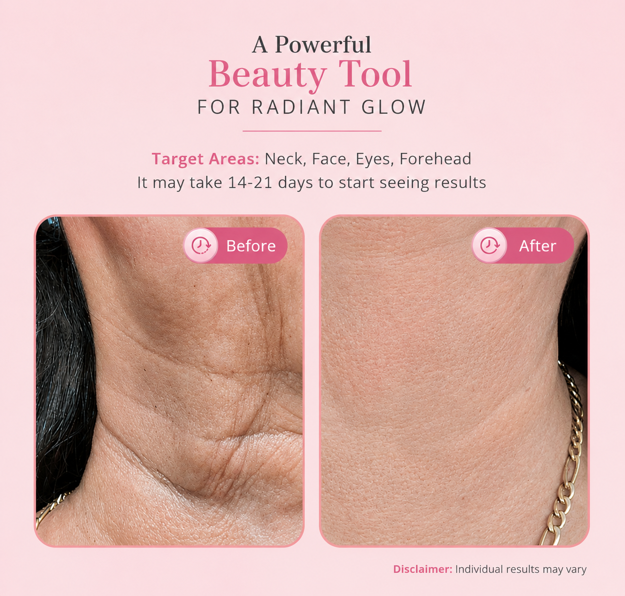 Zavelo ContourLift — Face Lifting Massage Device