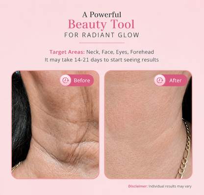 Zavelo ContourLift — Face Lifting Massage Device