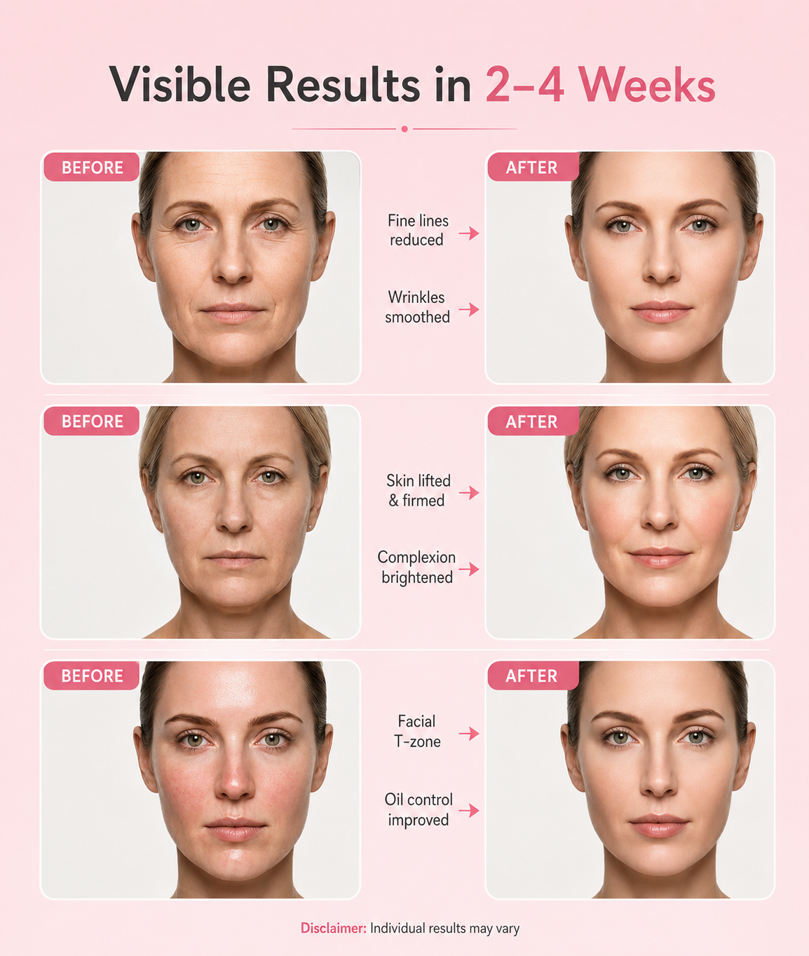 Zavelo ContourLift — Face Lifting Massage Device