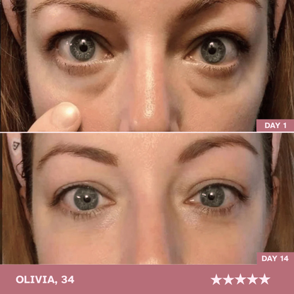 Brighter, More Awake Eyes! Just 10 Minutes a Day — Zavelo LumièreEye™