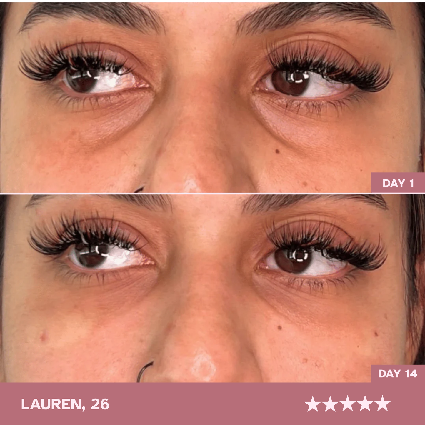 Brighter, More Awake Eyes! Just 10 Minutes a Day — Zavelo LumièreEye™