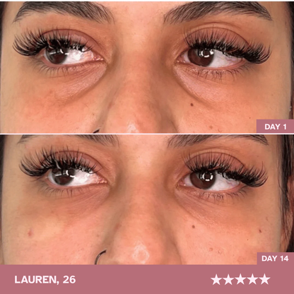 Brighter, More Awake Eyes! Just 10 Minutes a Day — Zavelo LumièreEye™